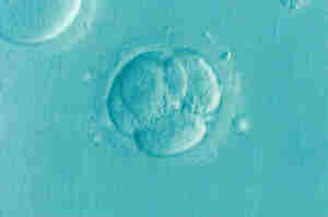 Sterilità ed infertilità maschile e femminile