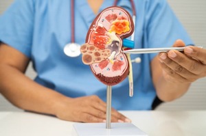 Malattia renale cronica: le novità delle linee guida KDIGO