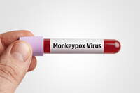 Monkeypox, il vaiolo delle scimmie