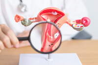 Endometriosi: il dolore ignorato che ritarda la diagnosi