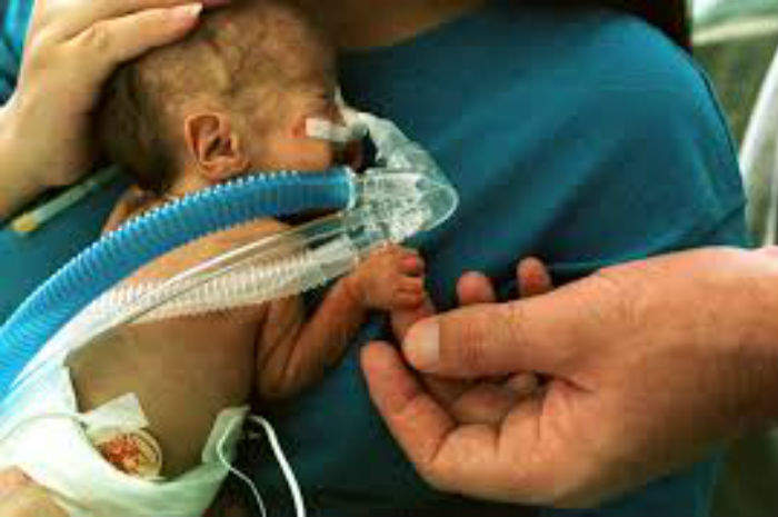 Pretermine e neonati prematuri, conseguenze sulla salute