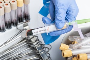 Aggiornamento linee guida ESC 2025 sulle dislipidemie