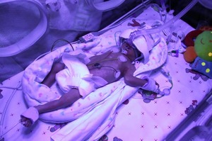 Gestione infermieristica del neonato con peso estremamente basso alla nascita
