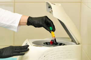 Plasma ricco di piastrine (PRP) nei siti donatori di innesto cutaneo