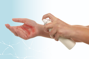 Sofargen® Spray: innovazione tecnologica nella gestione topica delle lesioni essudanti