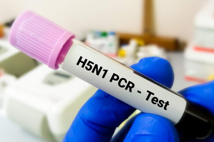 H5N1