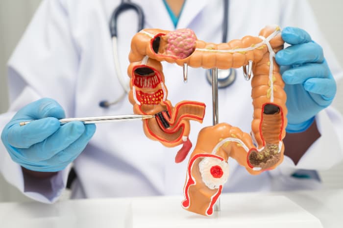 screening colon retto