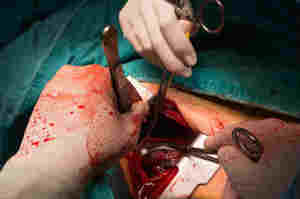 Toracotomia, l’apertura chirurgica del torace