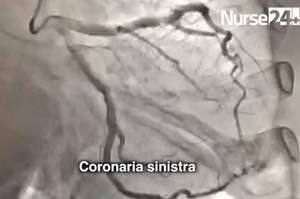 Coronarografia e angioplastica, competenze infermieristiche