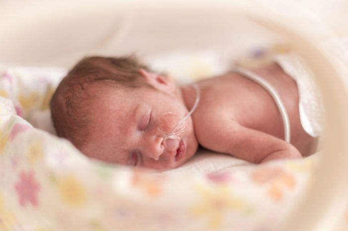 terapia intensiva neonatale