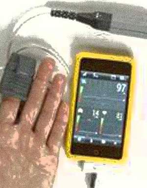 Un pulsiossimetro professionale per tablet e smartphones