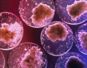 Cura dei tumori senza chemioterapia e nuove scoperte sui calcoli al...